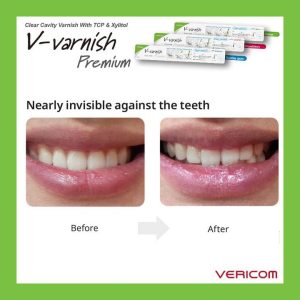 وارنیش دنفیل V-varnish 