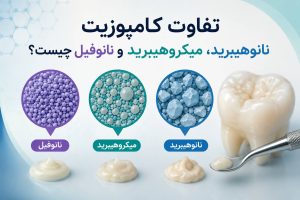 تفاوت-کامپوزیت