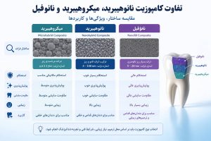 تفاوت کامپوزیت نانوهیبرید، میکروهیبرید و نانوفیل چیست؟