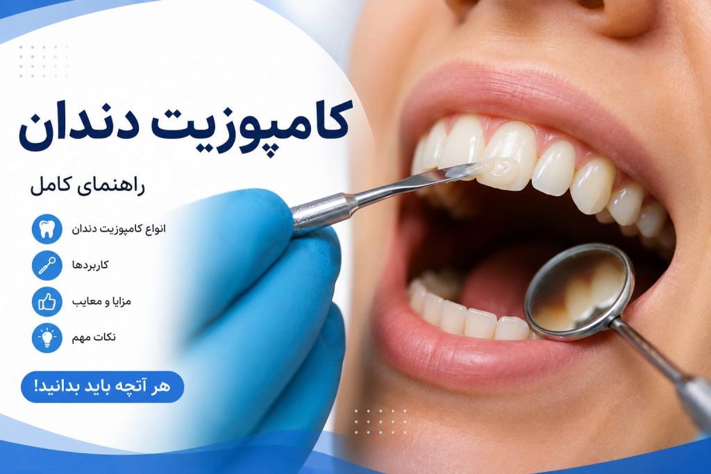 کامپوزیت چیست؟