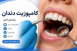 کامپوزیت چیست؟
